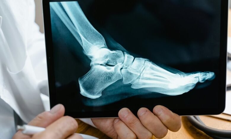 mobile call regional analysis